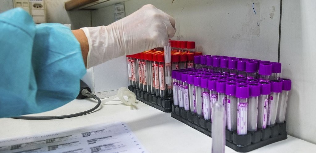 HOSPITAL INVESTIGA SE PACIENTES FORAM REINFECTADOS PELO CORONAVRUS