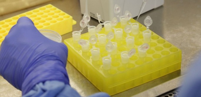 PLANOS DE SA�DE TER�O DE COBRIR EXAMES PARA O NOVO CORONAV�RUS