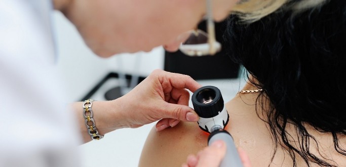 DIA C CONTRA O CNCER DE PELE OFERECE CONSULTAS NO HU-FURG