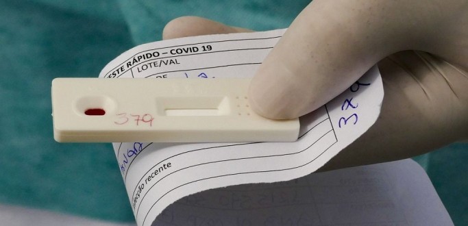 SAIBA COMO FAZER O TESTE DIAGNSTICO DE COVID-19 PELO PLANO DE SADE