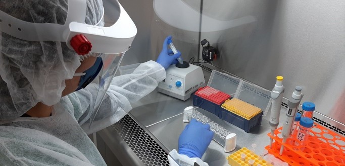 LABORATRIO DO HU-FURG PROCESSOU MAIS DE DEZ MIL TESTES PARA COVID-19